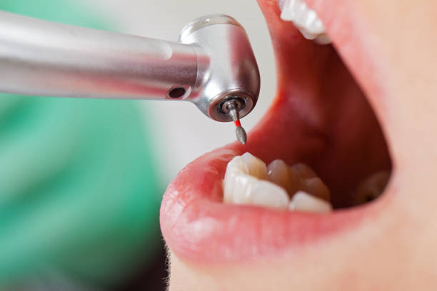 Best Urgent Dental Care for Toothache in Hopewell, VA